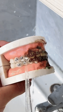 CleanJet מנקה לעומק ומעניק חיוך בריא תוך 30 שניות